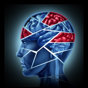 Signs & Symptoms of a Traumatic Brain Injury (TBI)
