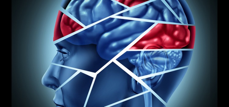 Signs & Symptoms of a Traumatic Brain Injury (TBI)